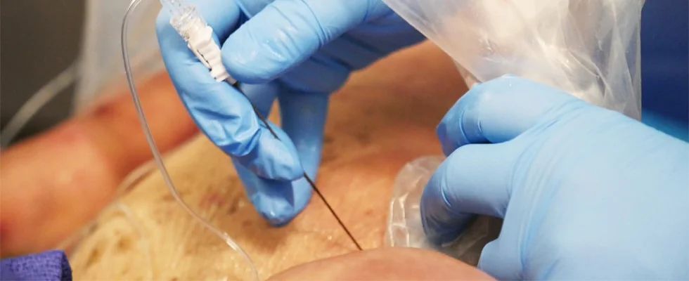 Nerve Block Injection