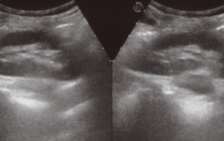 Maverick Medical Education