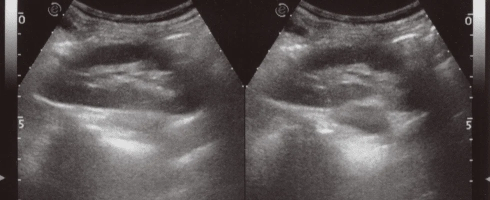 Maverick Medical Education