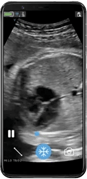 Curve Ultrasound Maverick Equipment: GE Vscan Air CL