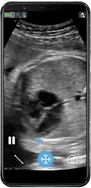 Curve Ultrasound Maverick Equipment: GE Vscan Air CL