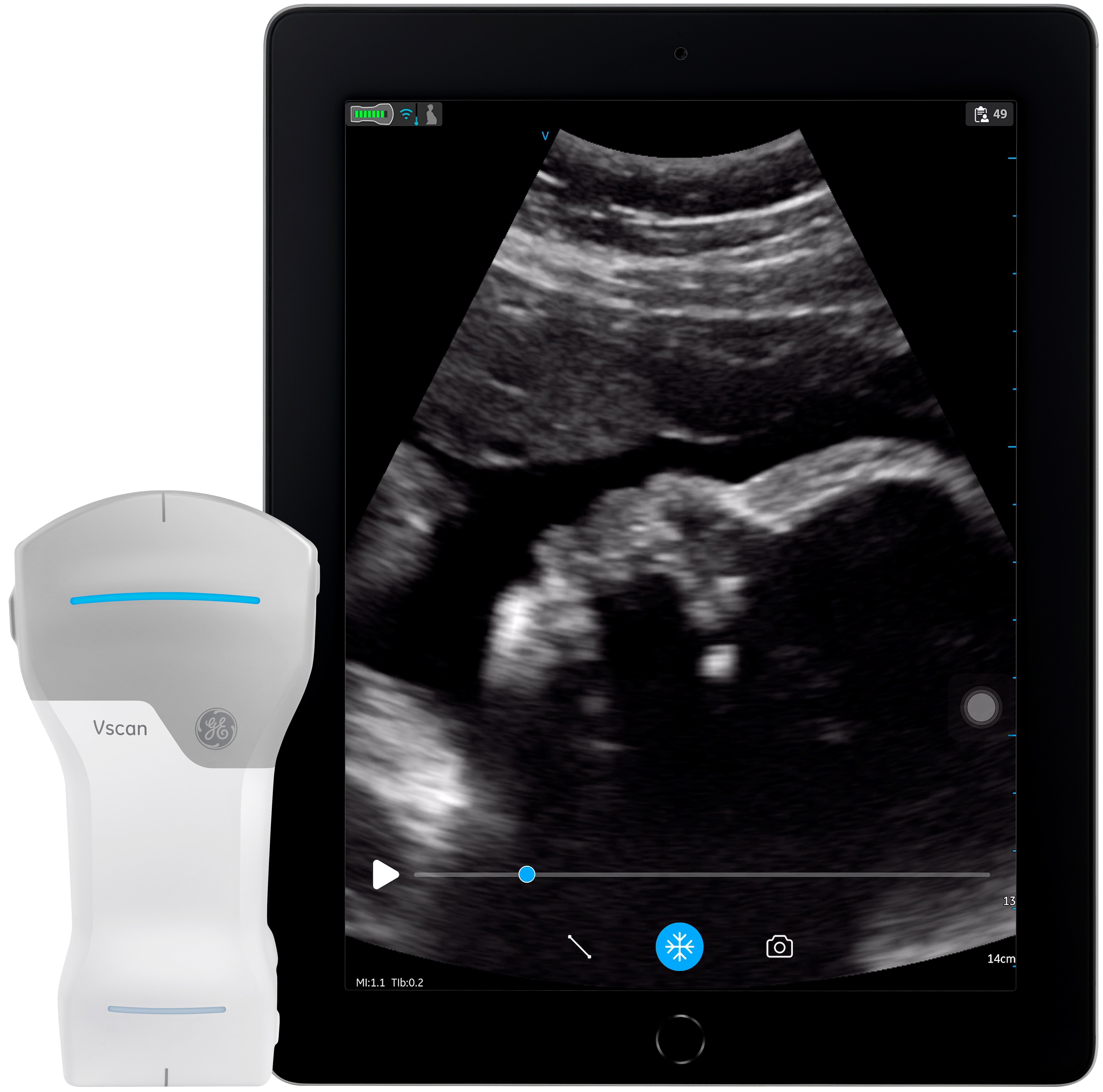 photo-vscan-air-iPad-fetal-profile Vscan Air Fetal profile.