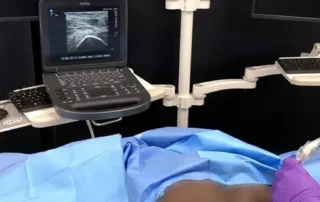 Ultrasound with Optima PENG volume gel.